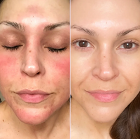 Harvest & Hive™ Organic Tallow Balm - Made in the UK 🇬🇧